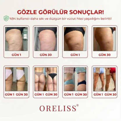 3'lü Etki Taytı Lipödem, Selülit, Varis Oreliss™