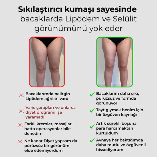3'lü Etki Taytı Lipödem, Selülit, Varis Oreliss™